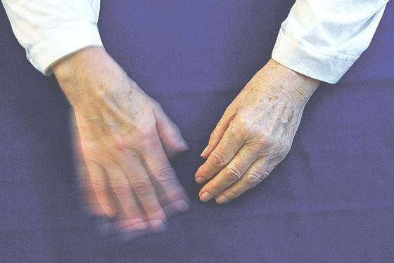 Hände, die nicht mehr stillhalten wollen: Sie sind nur ein Syptom der Erkrankung.	Foto: VA