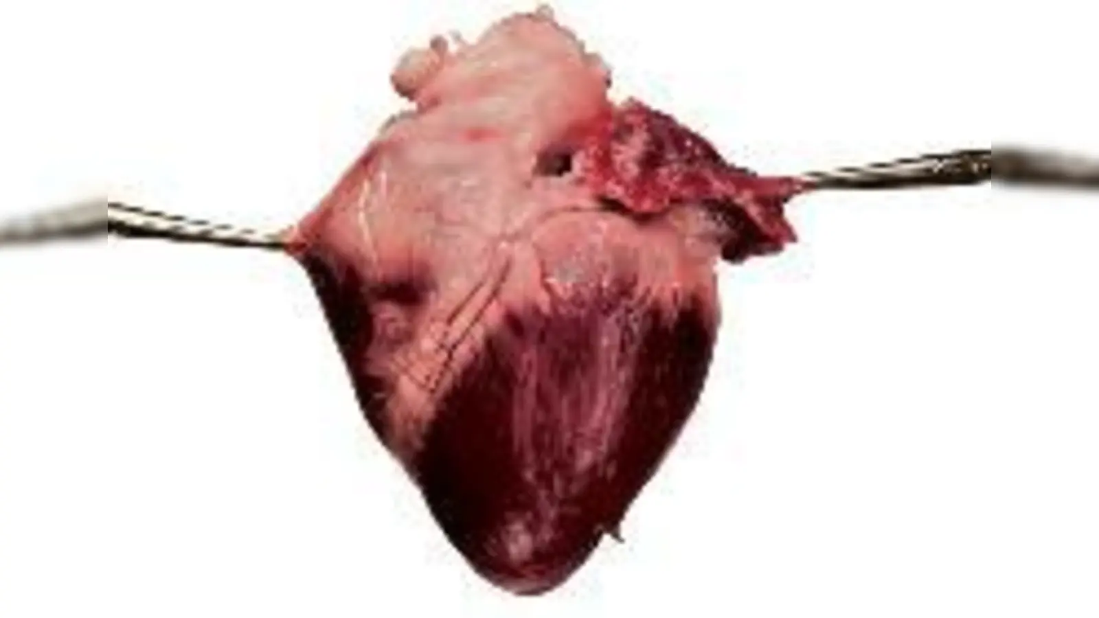 80 Prozent der Deutschen befürworten die Organspende, nur 15 Prozent allerdings haben in einem Spenderausweis festgelegt, dass sie ihr Herz im Fall der Fälle weitergeben  (würden.Bild: Archiv)