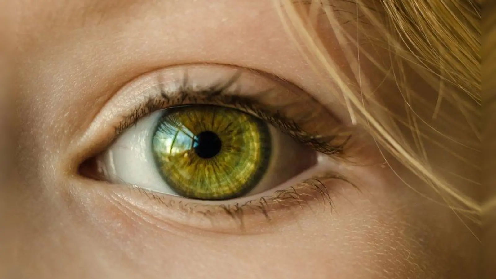 Wenn es um die Augen geht, sollte man keine Zeit verlieren. Die sogenannte Augengrippe ist hoch ansteckend. (Foto: pixabay)