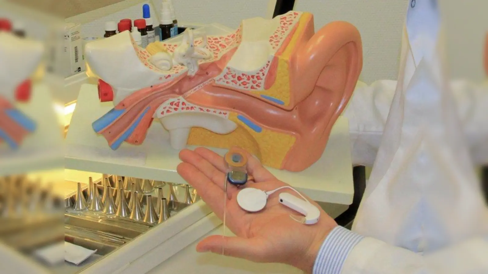 Cochlea-Implantate sind Hörprothesen für Gehörlose, deren Hörnerv nicht vollständig gestört ist. (Foto: us)