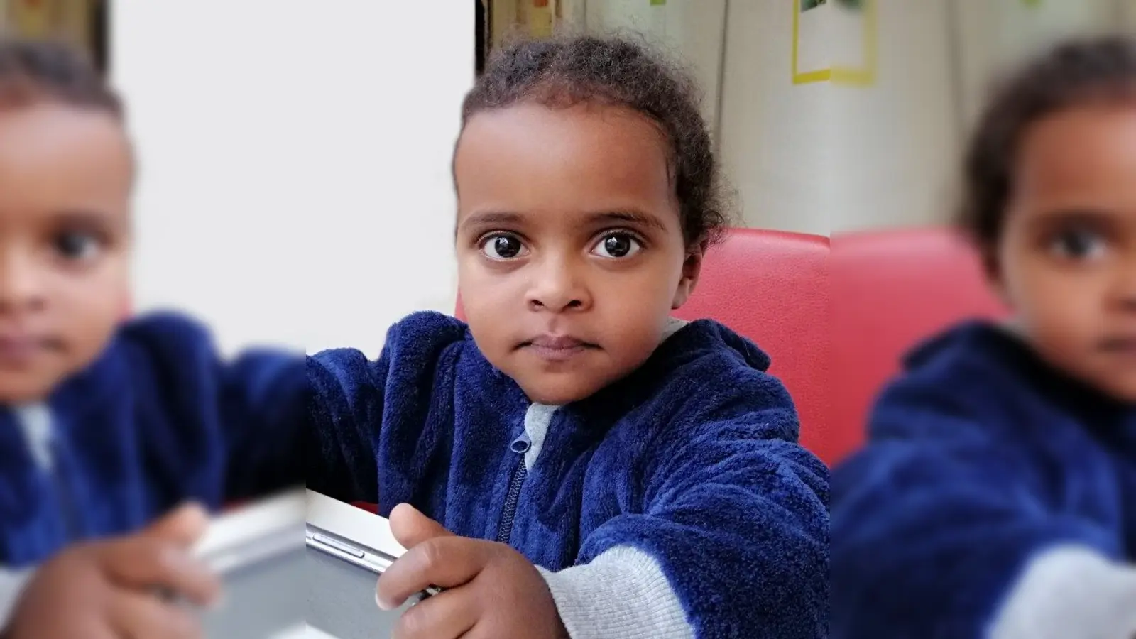 Fermosi braucht eine weitere OP. Ohne den Eingriff kann sie nicht überleben. (Foto: Deutsche Lebensbrücke e.V.)