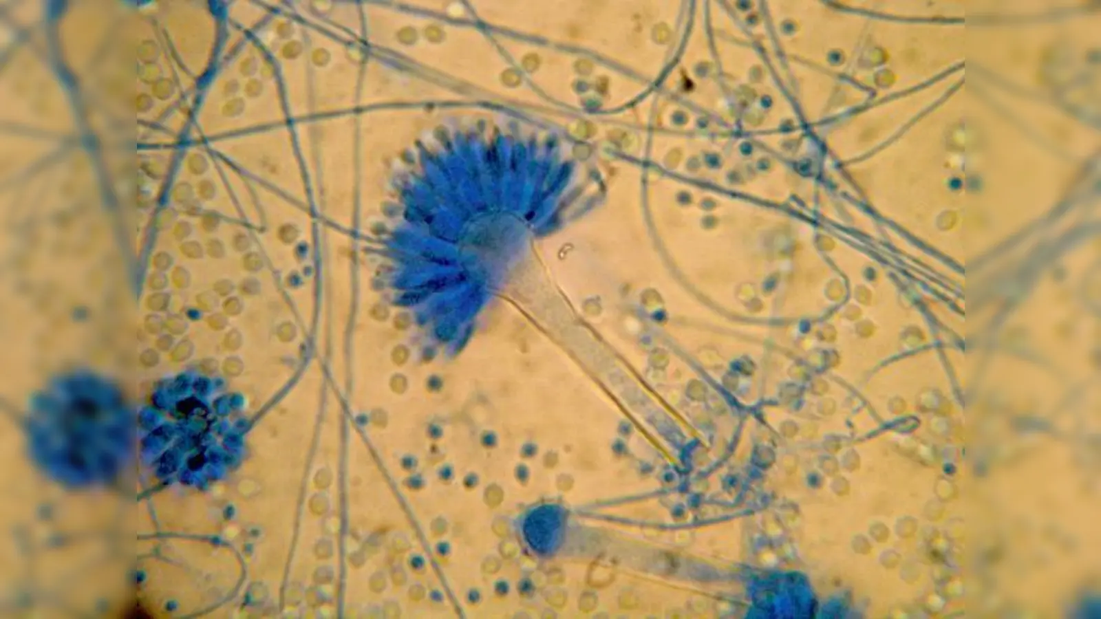 Eine Ausstellung über Schimmelpilze zum gucken, riechen und schmecken.	 (Foto: Privat)