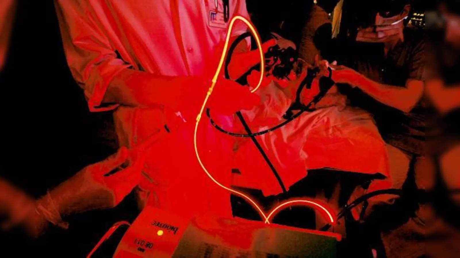 Laserlicht wird durch eine millimeterdünne Faser geleitet, die durch das Endoskop bis an Tumore des Gallenganges vorgeschoben wird.	 (Foto: StKM)