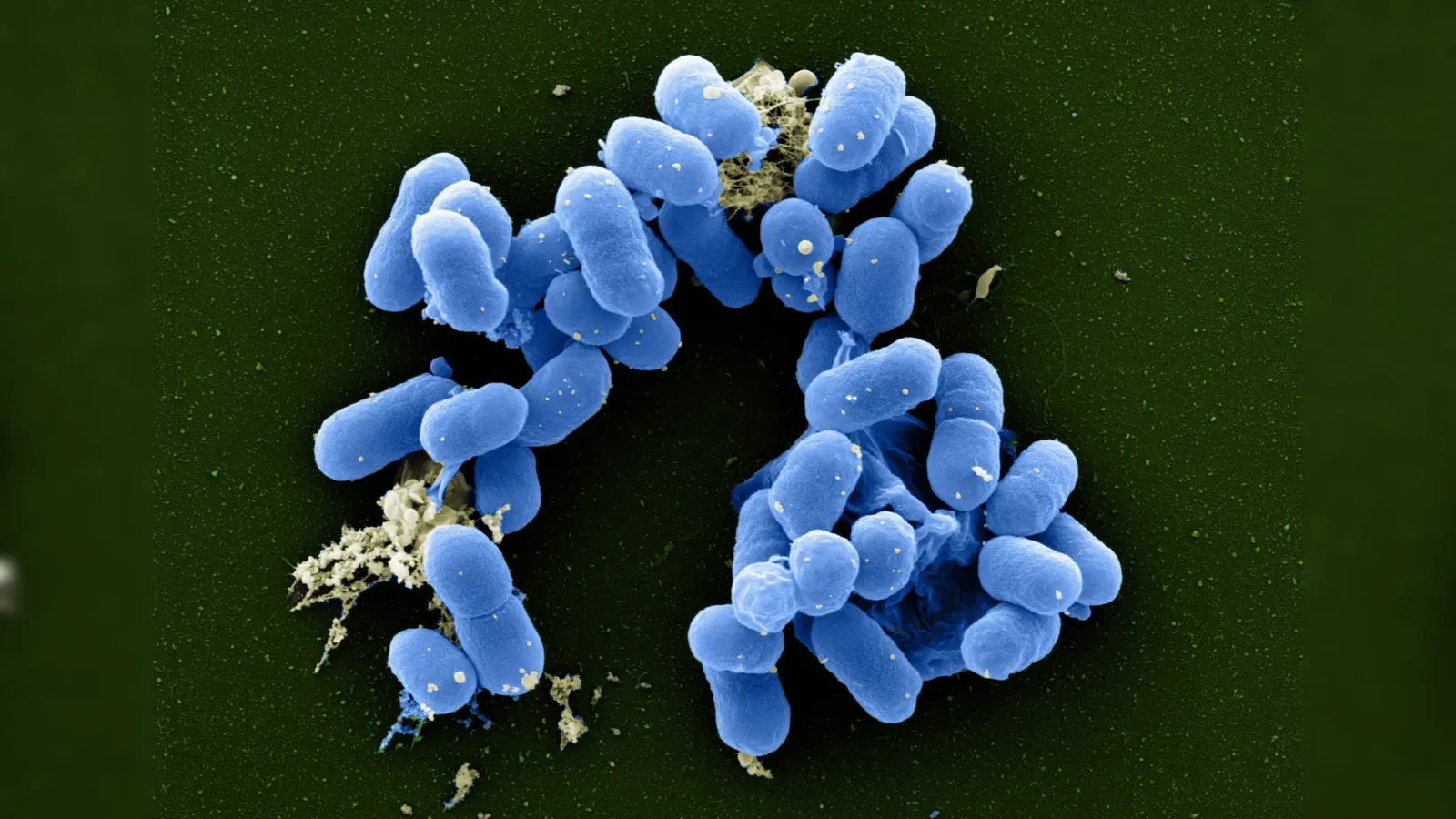 Gehört zu den coliformen Krankheitserregern: Enterohämorrhagische Escherichia coli Bakterien (EHEC) unter dem Raster-Elektronenmikroskopie, koloriert. (Foto: RKI / Michael Laue)