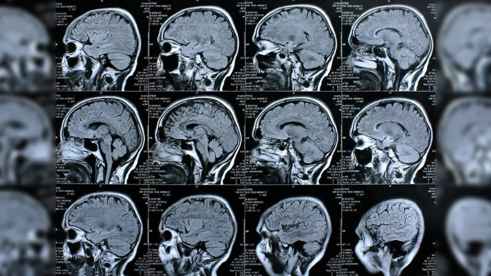 Schnittbilder (Foto: Rike/ pixelio.de)