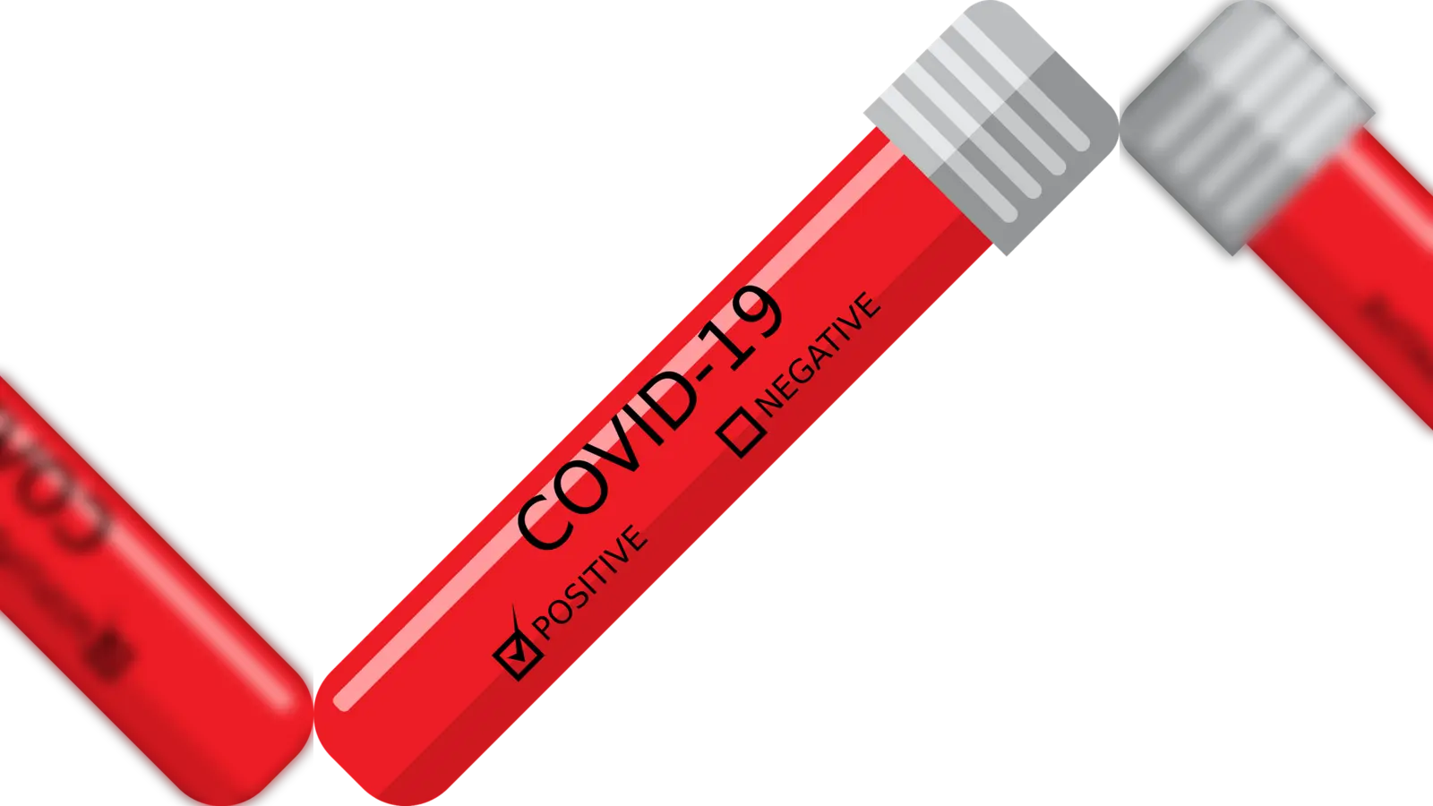 Wer ein positives Testergebnis erhält, muss sich umgehend für zehn Tage in Isolation begeben. (Symbolbild: CCO)