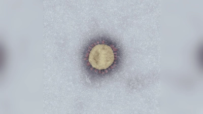 Das SARS-Coronavirus-2 (SARS-CoV-2) unter dem Elektronenmikroskop. (Foto: Robert Koch-Institut)