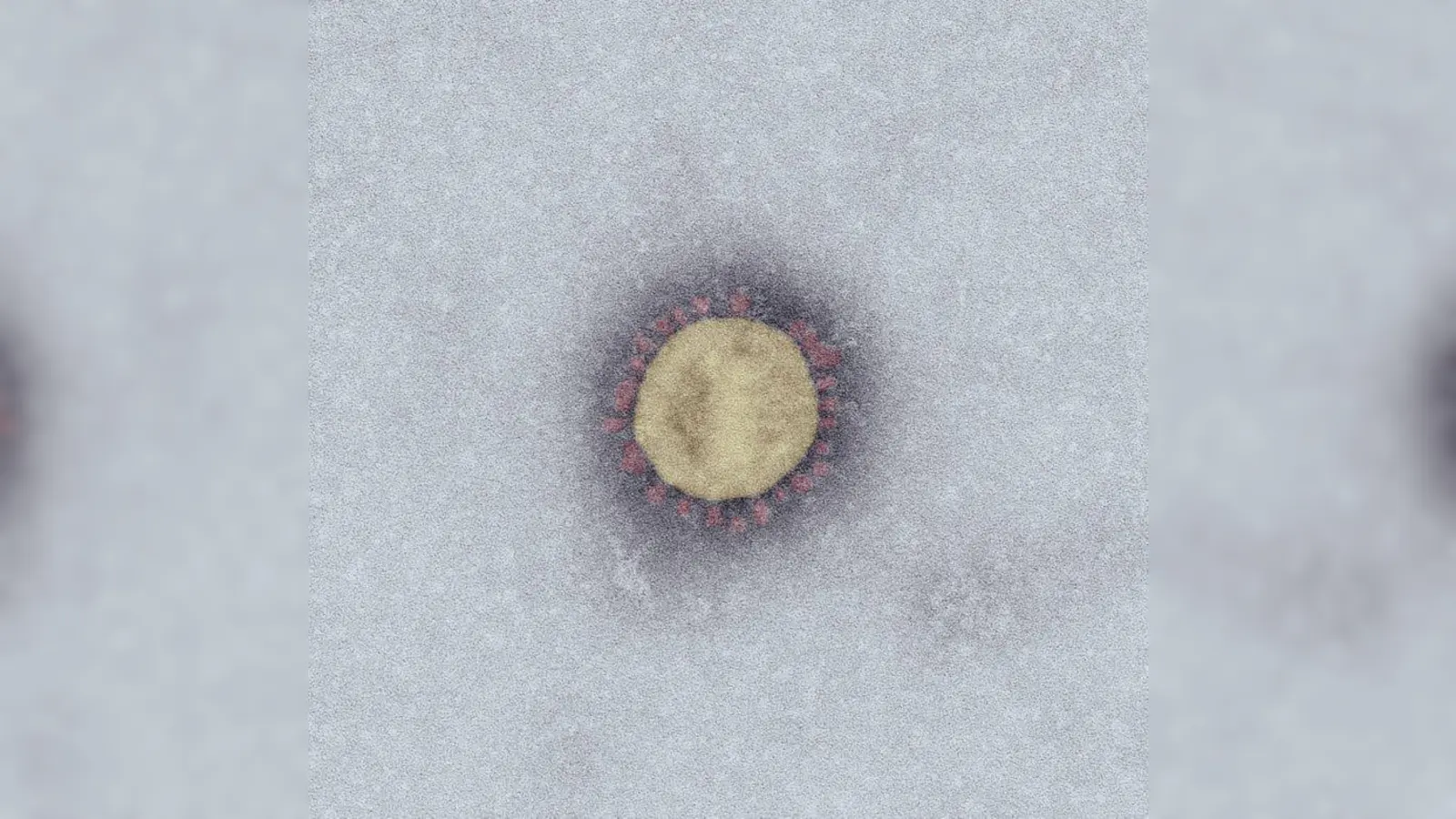 Das SARS-Coronavirus-2 (SARS-CoV-2) unter dem Elektronenmikroskop. (Foto: Robert Koch-Institut)
