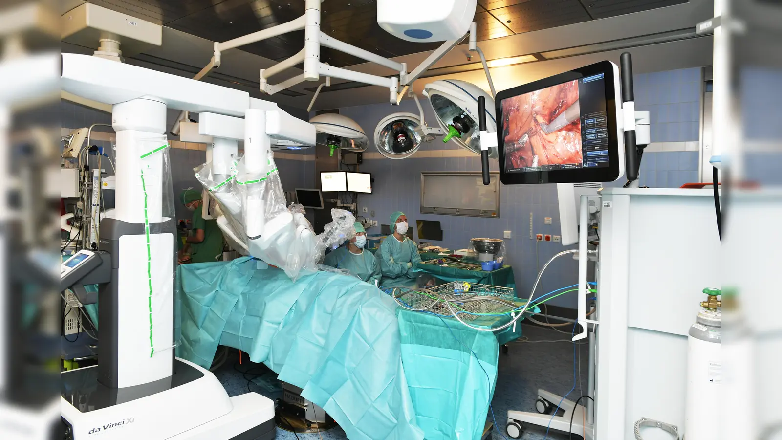 Die München Klinik Bogenhausen wurde kürzlich mit dem hochmodernen OP-Robotersystem „Da Vinci Xi“ ausgestattet. (Foto: München Klinik)