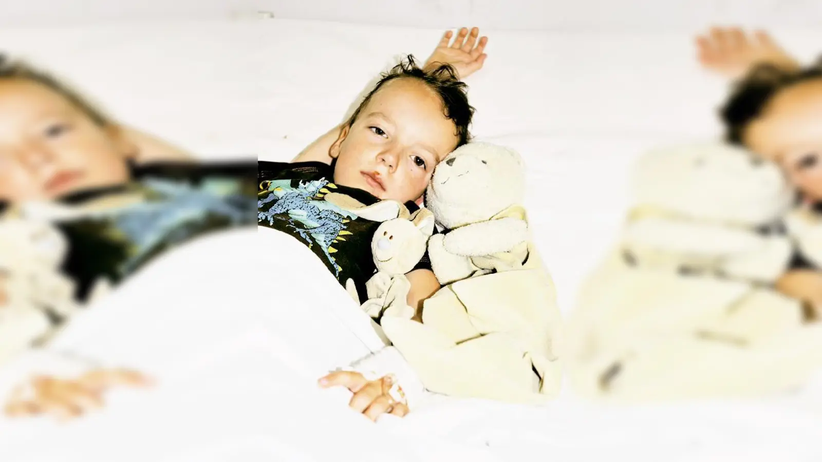 Marvin aus Moosach wurde von einem Radfahrer angefahren und erlitt einen Oberschenkelbruch und Verletzungen im Gesicht.	 (Foto: Polizei)