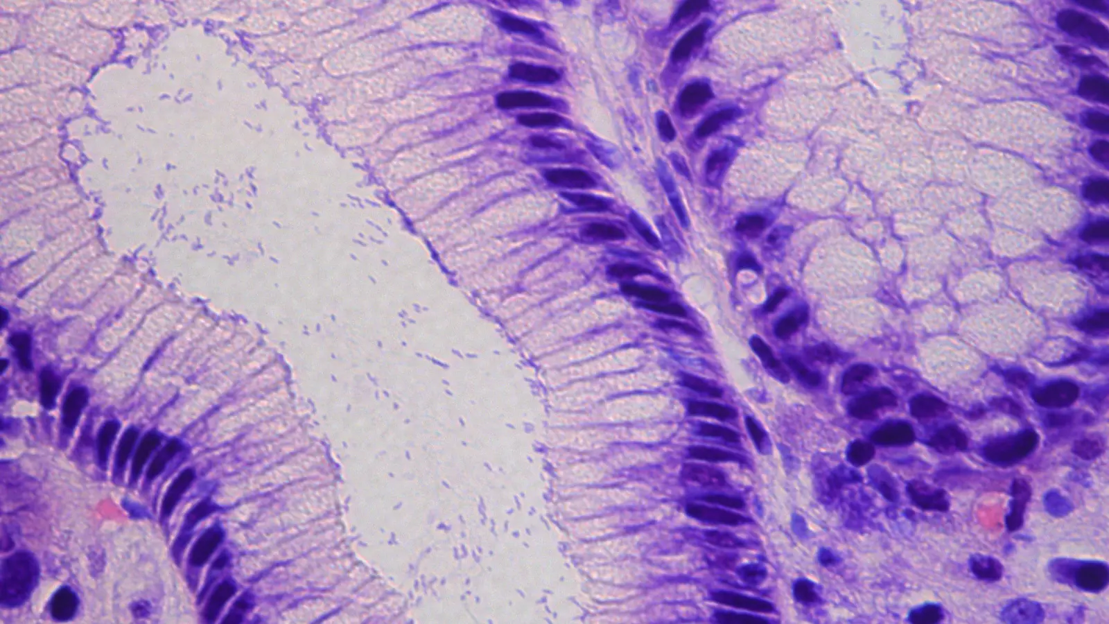 Ein bedeutender Fortschritt zur Vorbeugung gegen Magenkrebs. TUM erforscht neuen Wirkstoff. (Foto: Raquel Mejías Luque / TUM)