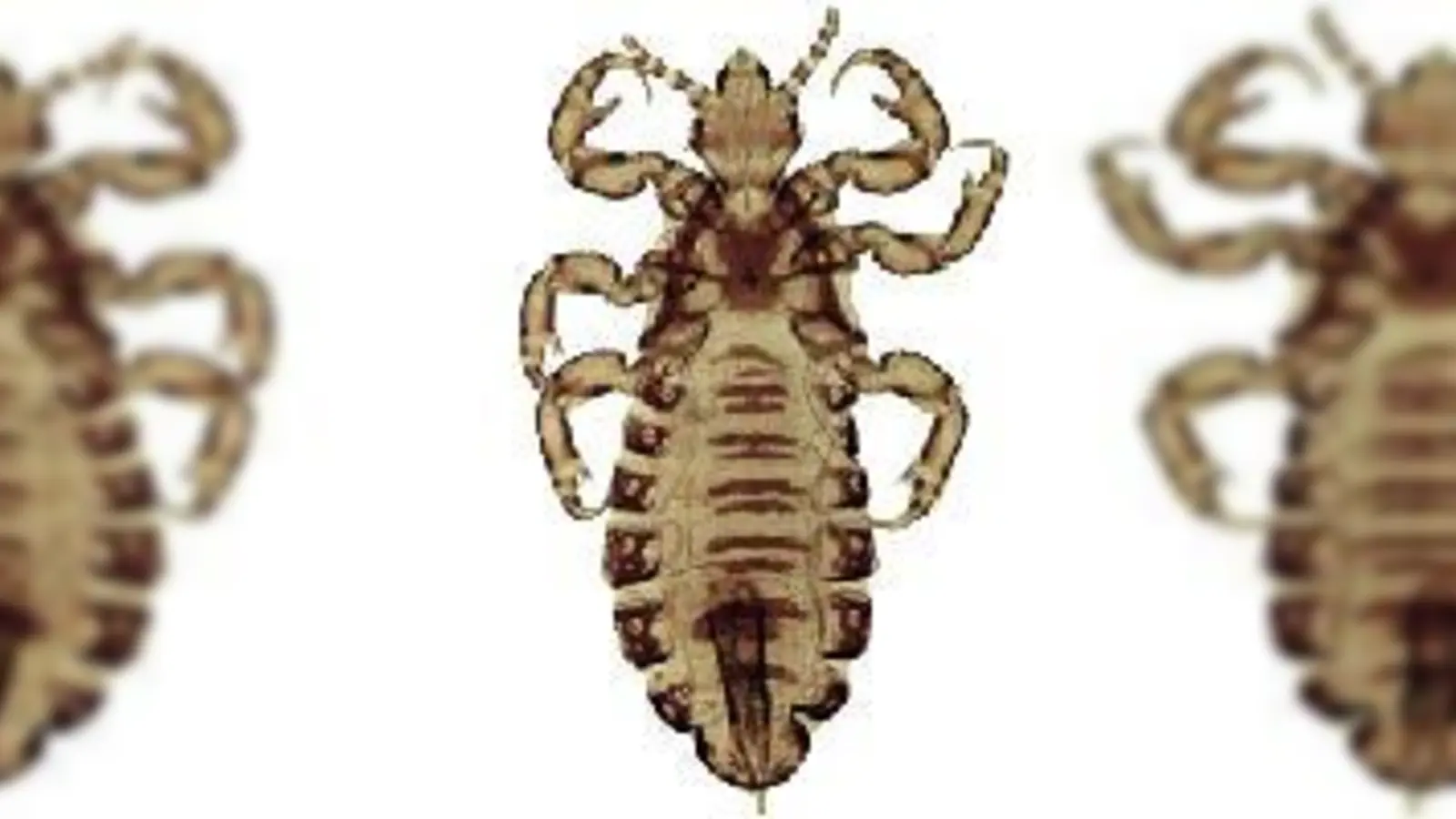 Läuse sind zwar ungefährlich, aber lästig und verbreiten sich (schnell.Foto: Archiv)