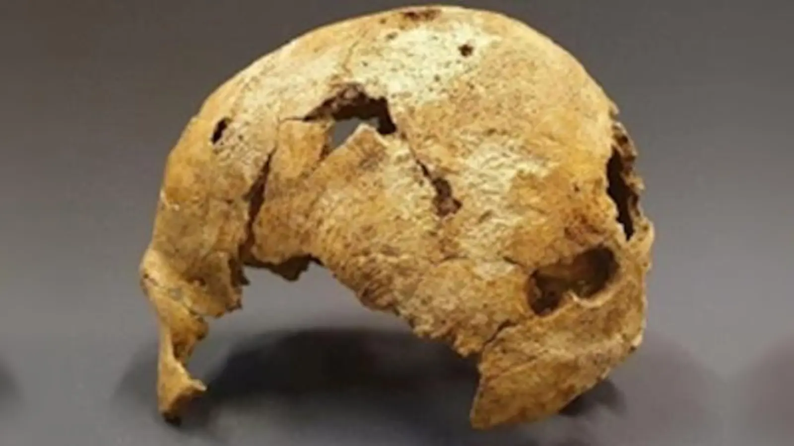 Ein ﻿Schädelknochen aus dem 6. oder 7. Jahrhundert, gefunden in Aschheim. (Foto: 13)