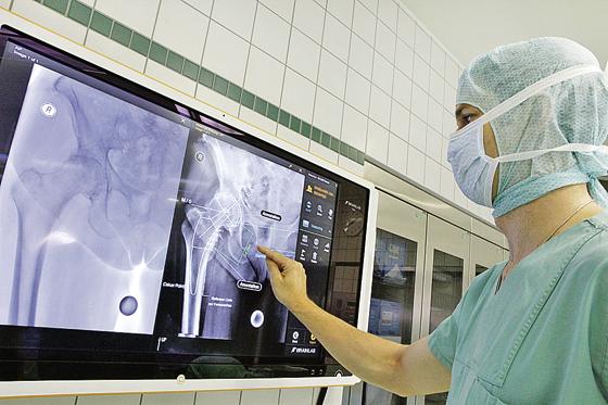 Ein Arzt mit einer Röntgenaufnahme zum Hüftgelenkersatz.	Foto: VA