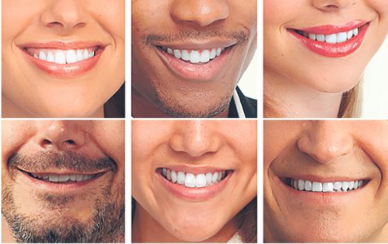 Studien zufolge werden Menschen mit schönen Zähnen unterbewusst als sympathischer, gesünder und erfolgreicher wahrgenommen.