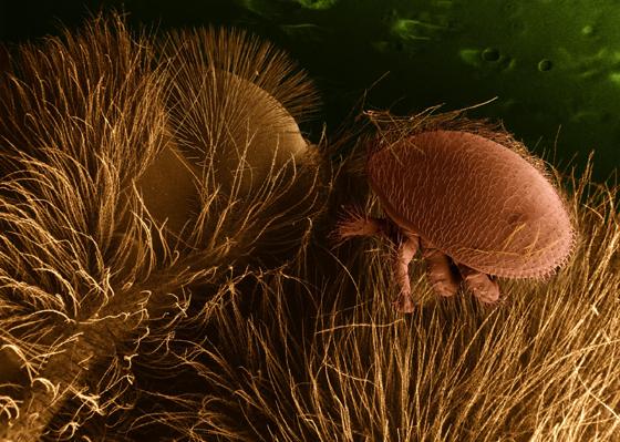 Die schädliche Varroamilbe auf einer Biene im Rasterelektronenmikroskop. Foto: gemeinfrei