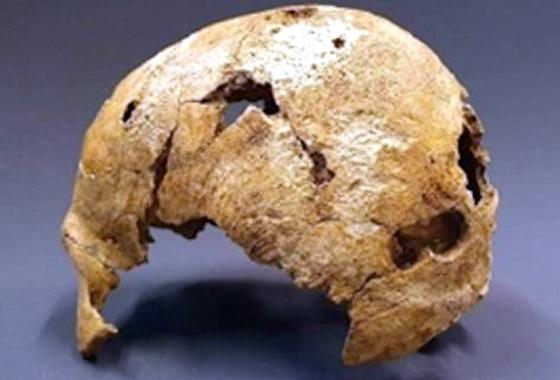 Ein Schädelknochen aus dem 6. oder 7. Jahrhundert, gefunden in Aschheim. Foto: AschheiMuseum